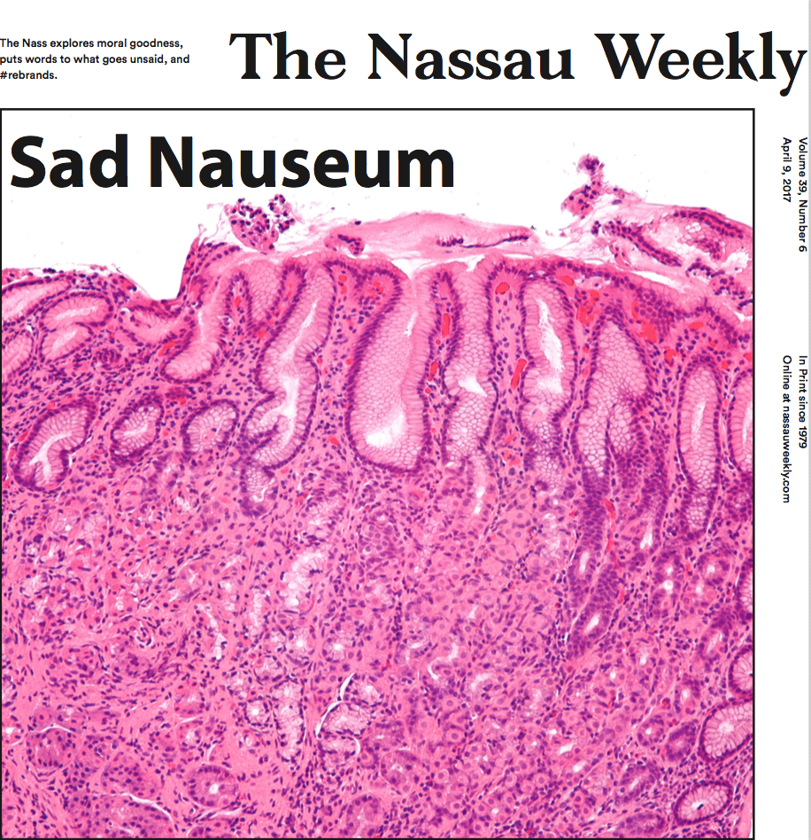 Dancing Around the “S-word”