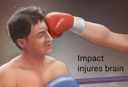 Encounters With Concussion Culture